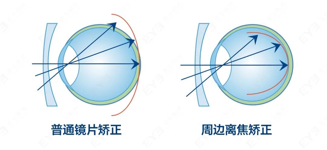 图片.png 图片.png